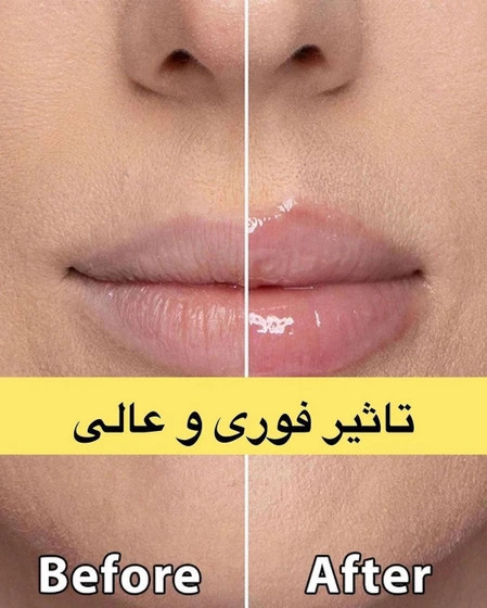حجم دهنده لب هلویی اصلی